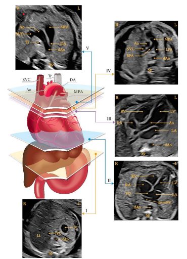 Focused cardiac imaging for complete reassurance