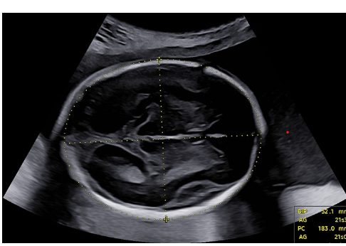 Growth Scan with Dopplers